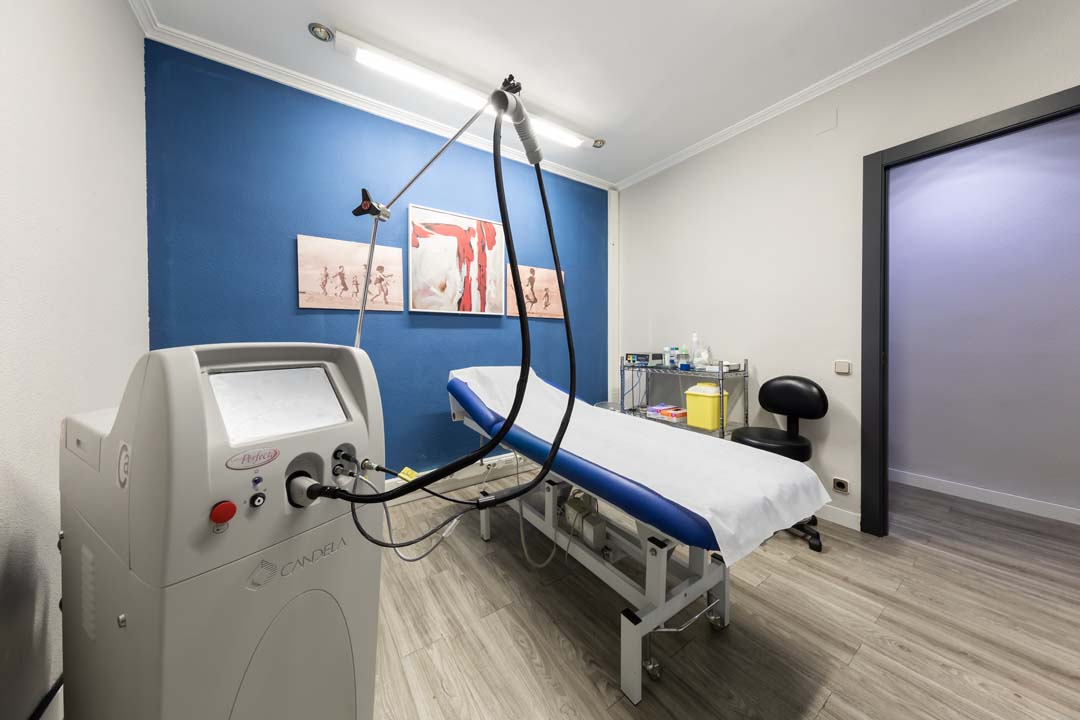 Láser vascular VBeam Perfecta en Valencia